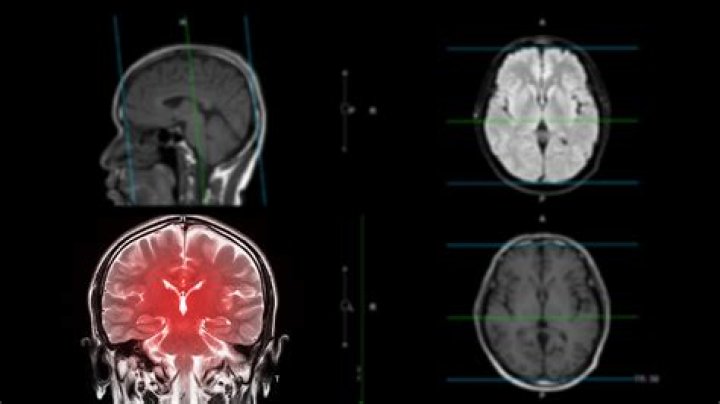 What is a CTE scan, and what are its implications for performance?