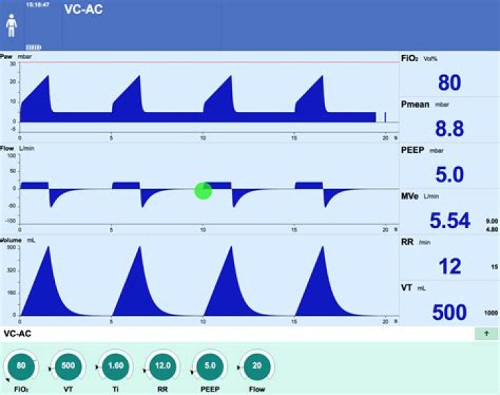 What is HWND in VC++